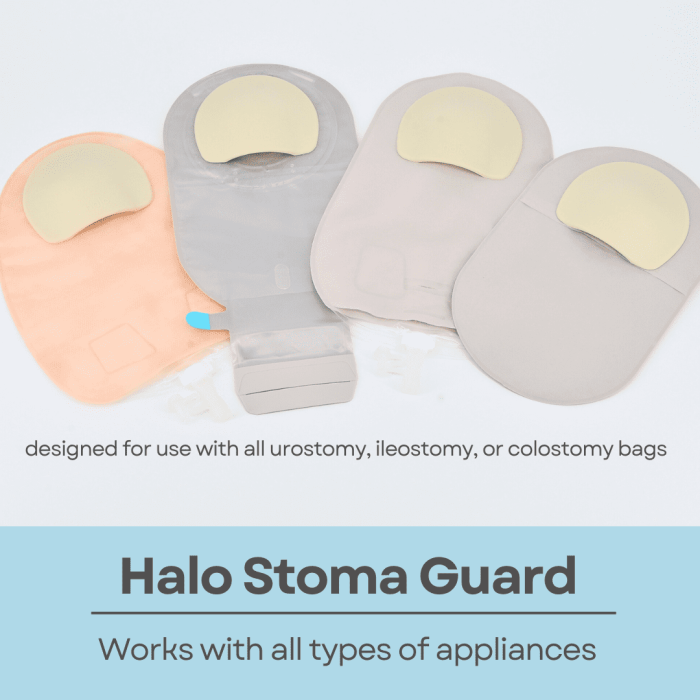 Stealth Belt Halo stoma guard kit